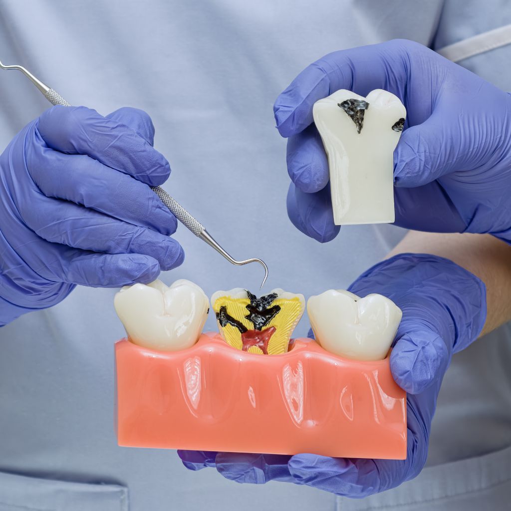 Wisdom tooth extraction treatment