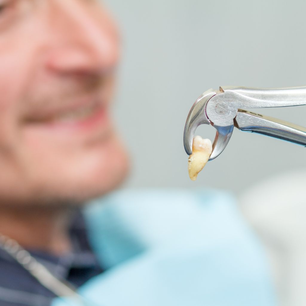 Dental extraction treatment
