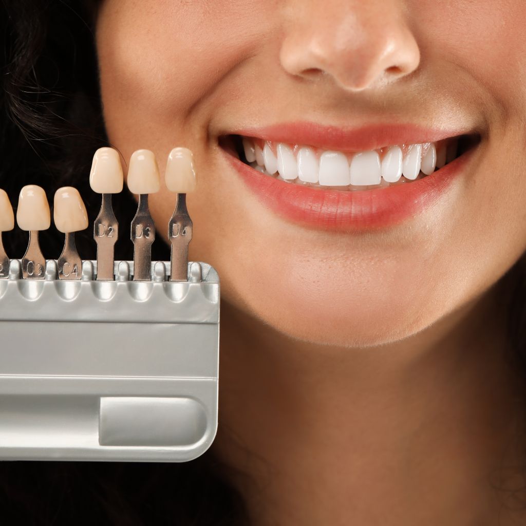 Veneers cosmetic dental treatment