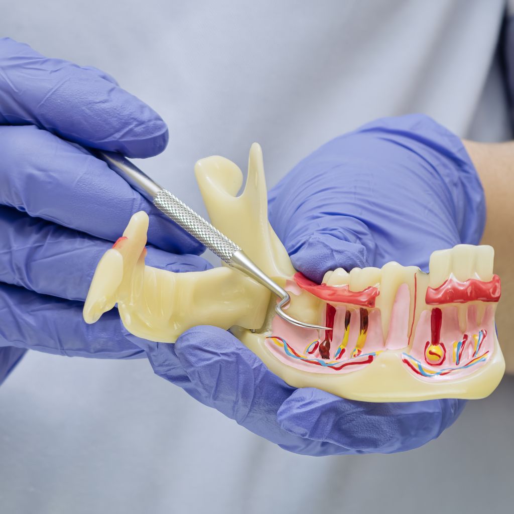 Periodontal care treatment